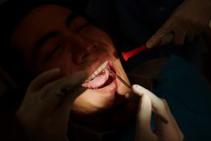 checking-front-teeth-of-male-patient-GWTHGKA (1)