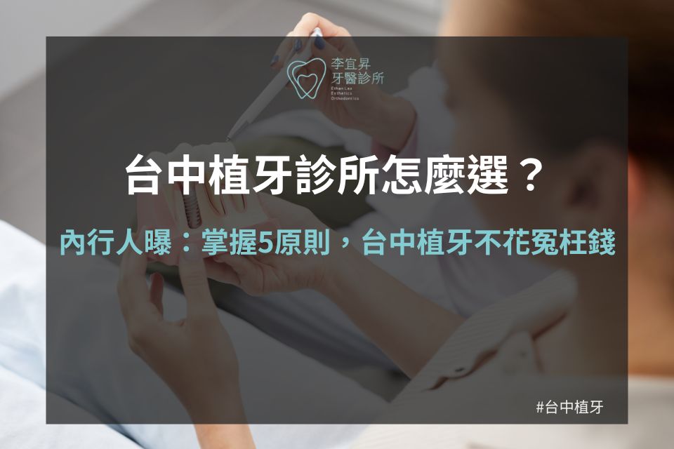 Read more about the article 台中植牙診所怎麼選？內行人曝：掌握5原則，台中植牙不花冤枉錢！