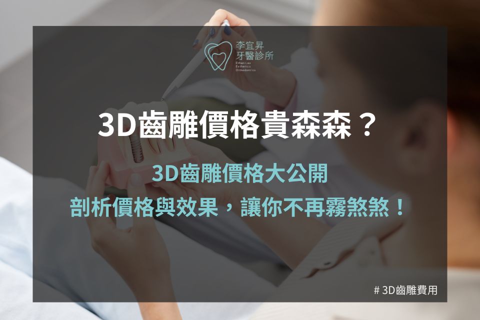 3D齒雕價格貴森森?3D齒雕價格大公開,剖析價格與效果,讓你不再霧煞煞!