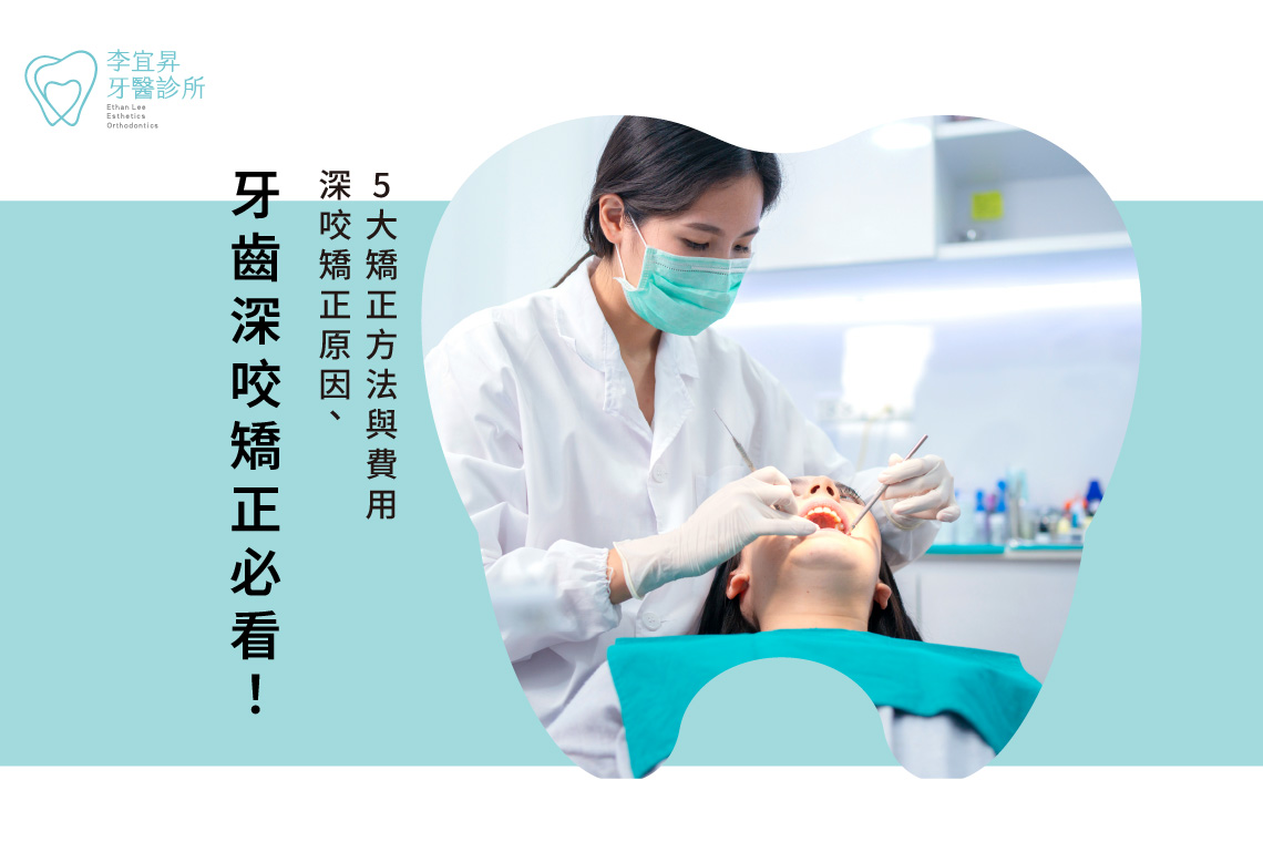 Read more about the article 牙齒深咬矯正必看！深咬矯正原因、5大矯正方法與費用