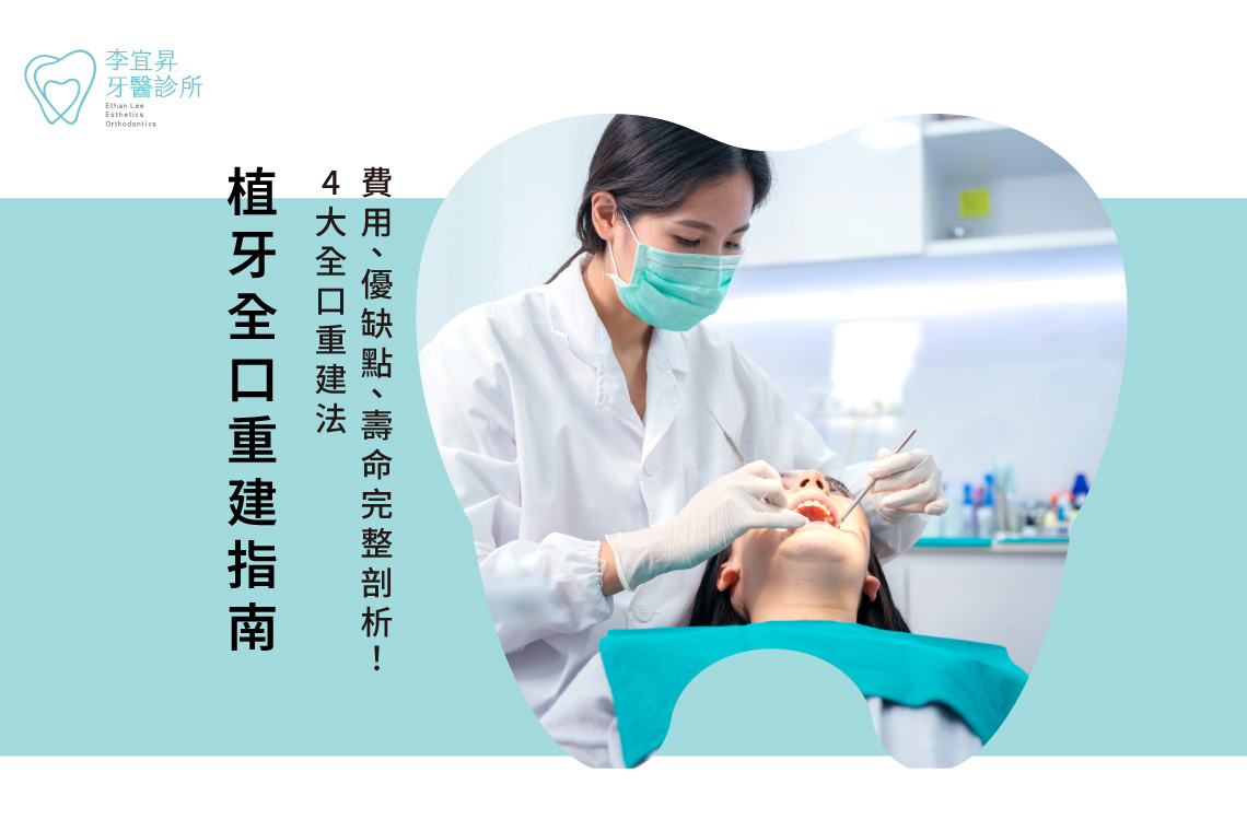 植牙全口重建指南：4大全口重建法，費用/優缺點/壽命完整剖析！