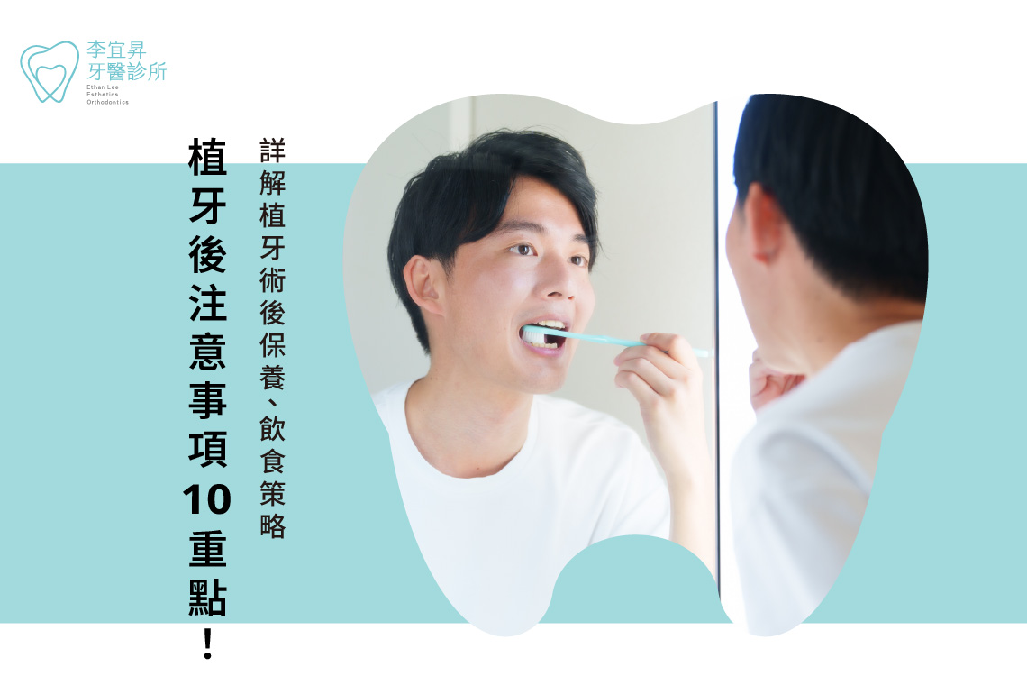 All on 4優缺點大比拚！專業醫師教你如何避免All on 4缺點！