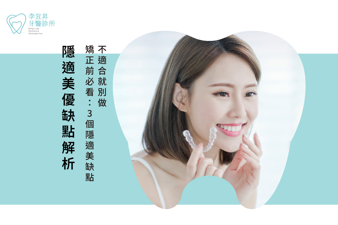 Read more about the article 隱適美優缺點解析｜矯正前必看：3個隱適美缺點，不適合就別做