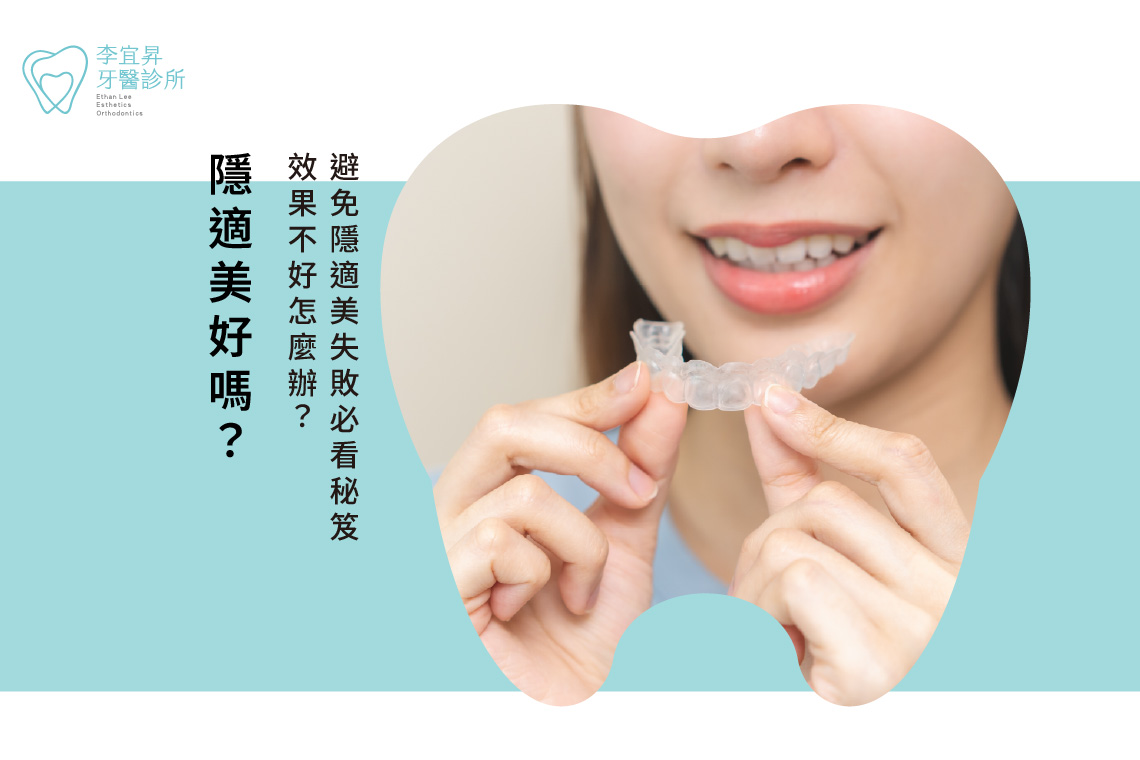 Read more about the article 隱適美好嗎？效果不好怎麼辦？避免隱適美失敗必看秘笈