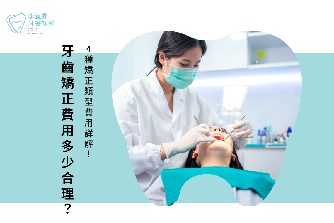Read more about the article 牙齒矯正費用多少合理？4種矯正類型費用詳解！