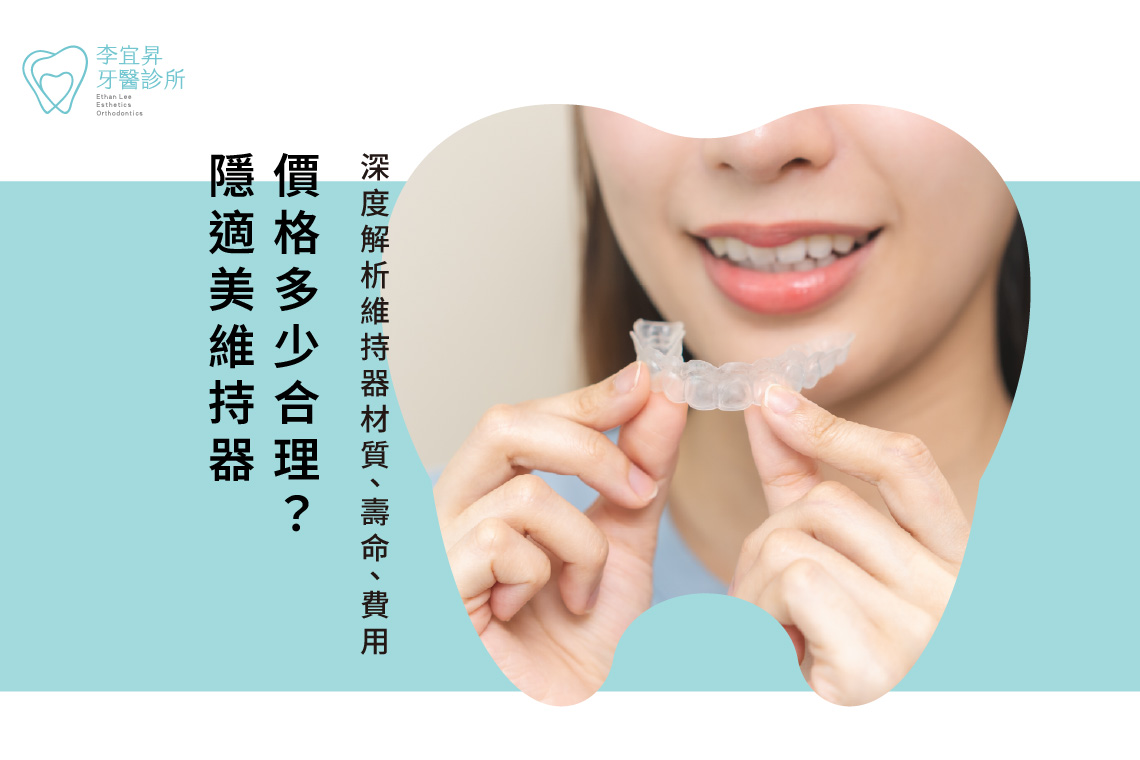 Read more about the article 隱適美維持器價格多少合理？深度解析維持器材質、壽命、費用