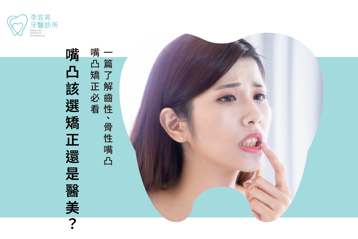Read more about the article 嘴凸該選矯正還是醫美？嘴凸矯正必看：一篇了解齒性、骨性嘴凸！