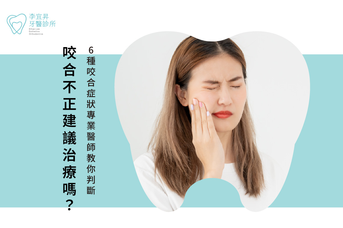 咬合不正建議治療嗎？6種咬合症狀專業醫師教你判斷