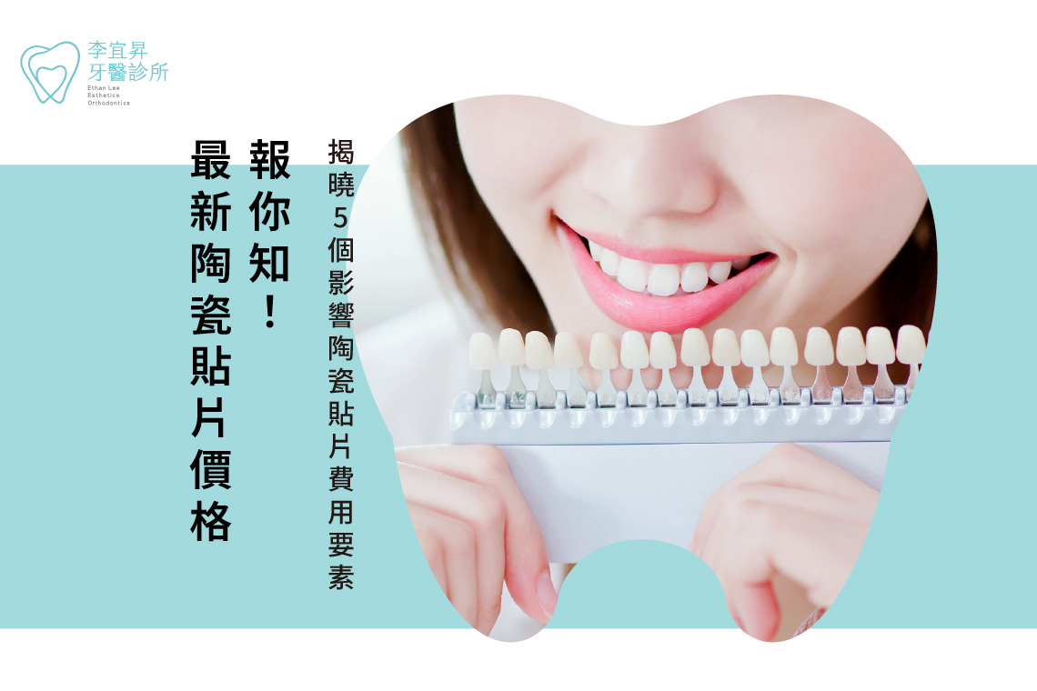 Read more about the article 最新陶瓷貼片價格報你知！揭曉5個影響陶瓷貼片費用要素