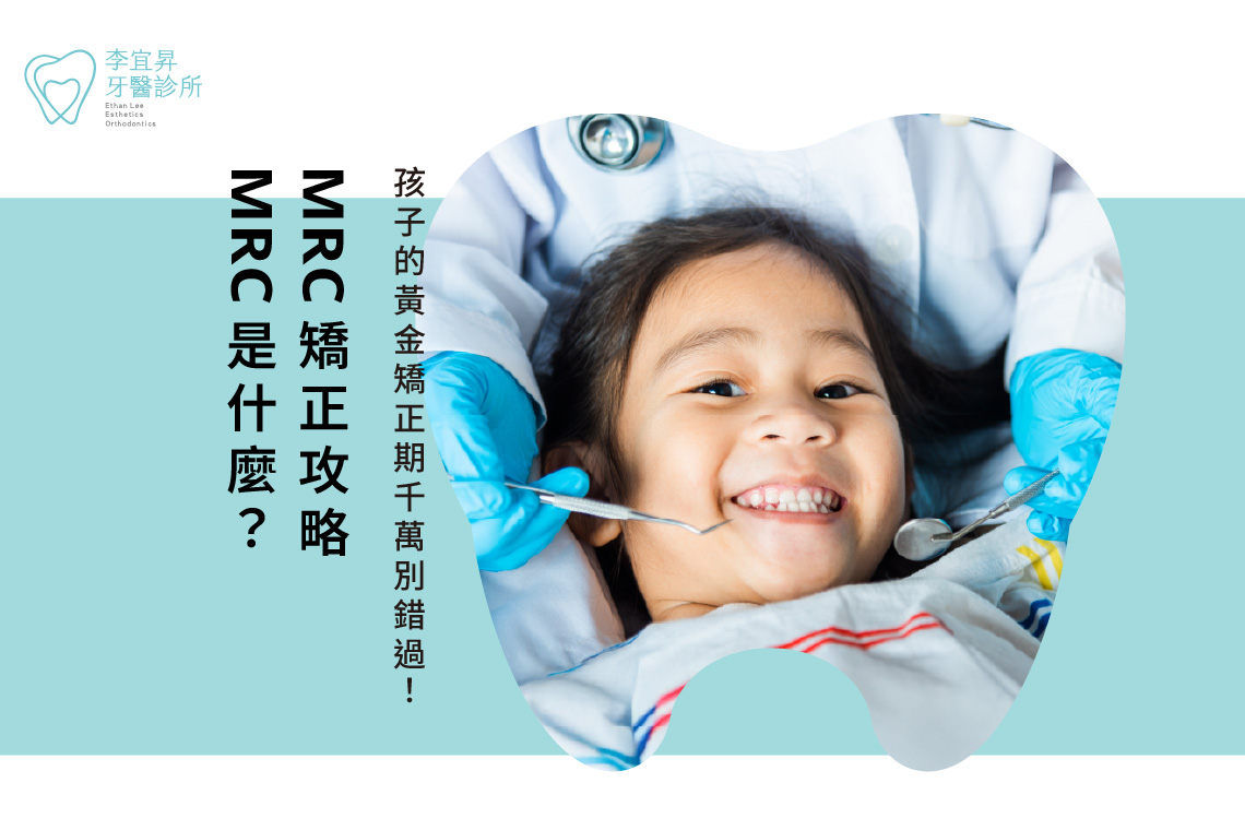 Read more about the article MRC是什麼？MRC矯正全攻略：孩子的黃金矯正期千萬別錯過！