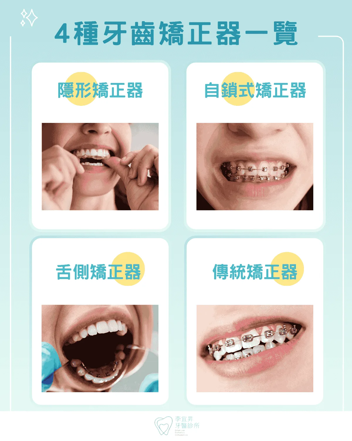 牙齒矯正器