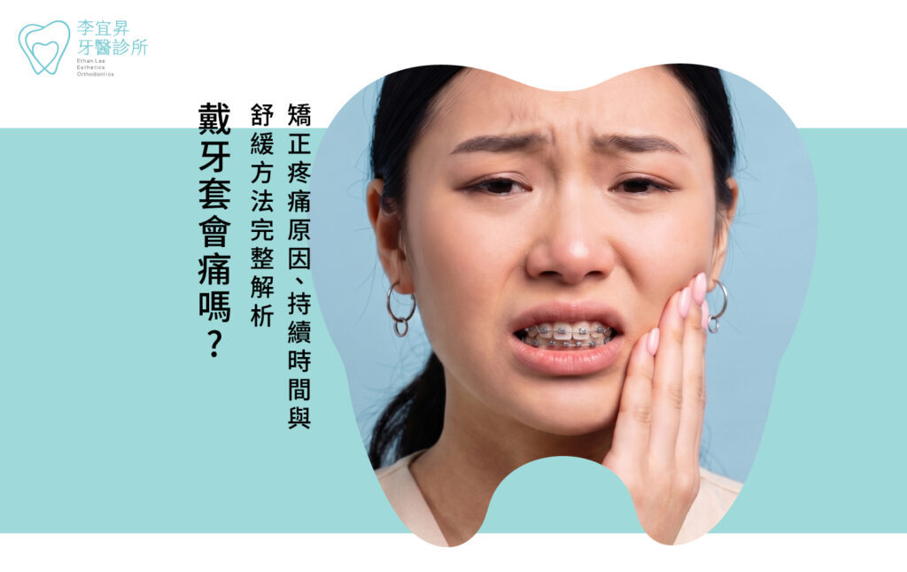 戴牙套矯正疼痛原因、持續時間與舒緩方式解析