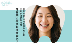 牙齒矯正前後有什麼變化?臉型改變、諮詢準備與戴牙套注意事項完整說明